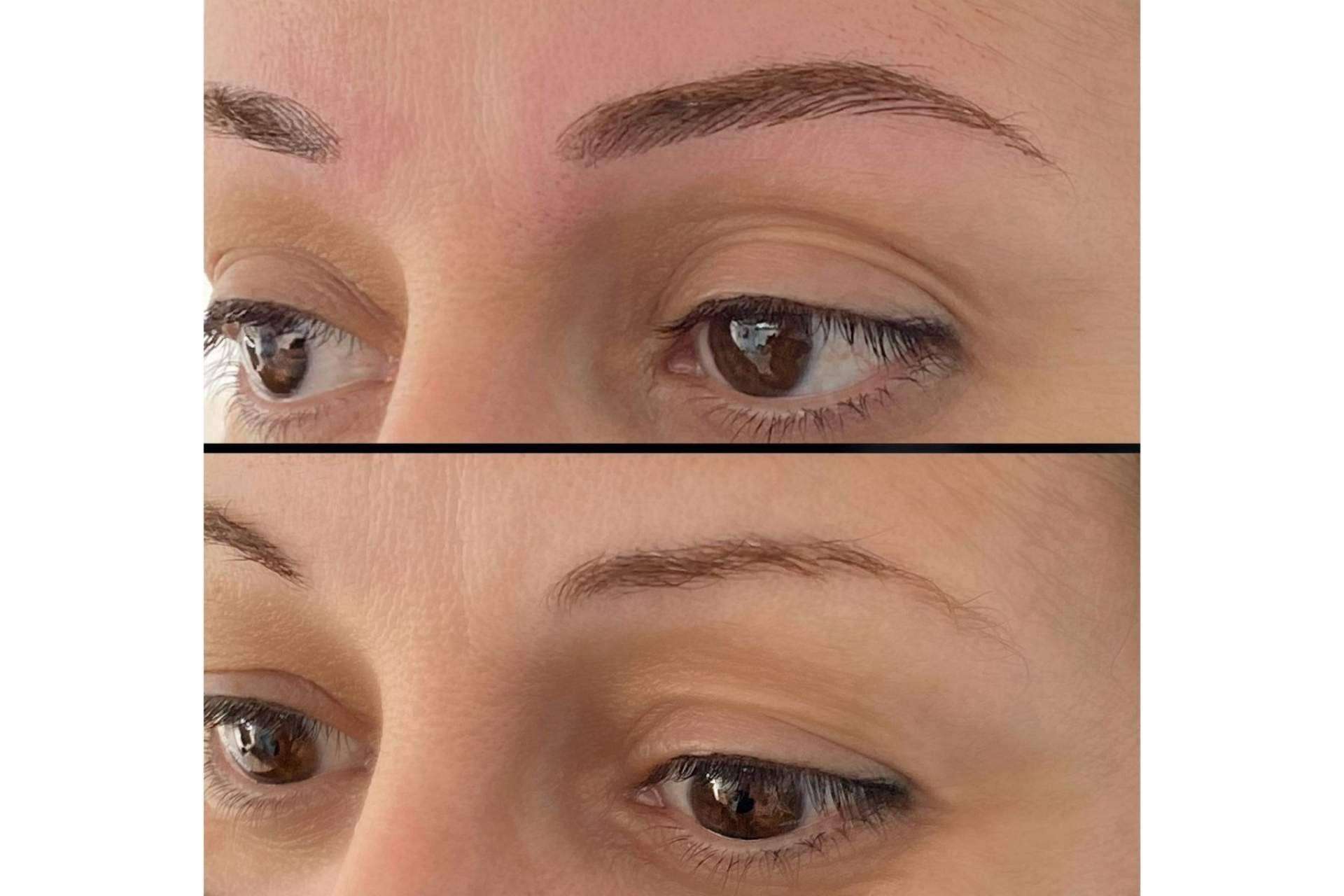 ¿Cómo lucir un rostro siempre perfecto? Microblading de la Dra. Julieta Gil