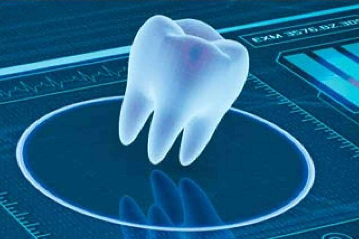 Odontología digital de la mano de Clínica Blay Monzó: las técnicas avanzadas en implantología