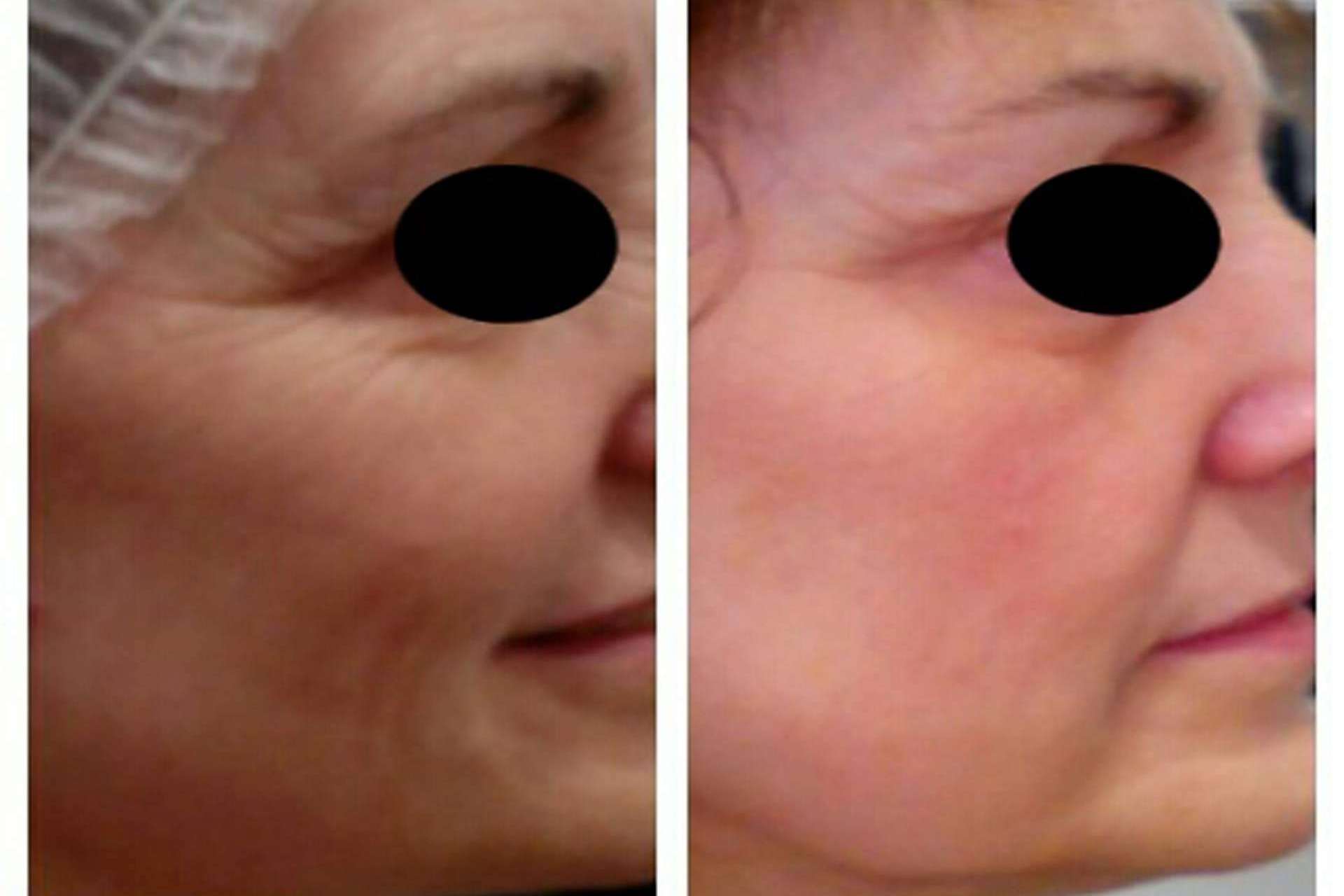 Conseguir una piel de porcelana con tratamiento facial antimanchas y otros tratamientos faciales icónicos de MiCleo&Co