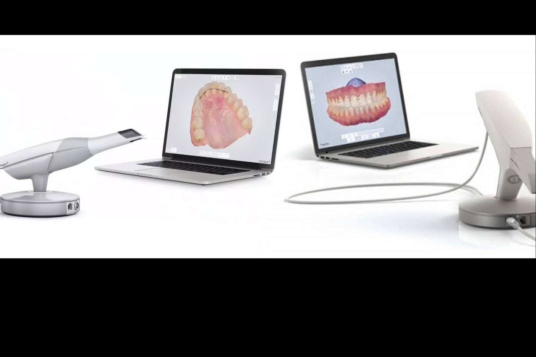 Toma de registros con 3Shape TRIOS, un escáner de última tecnología en la clínica dental Implant Clinics