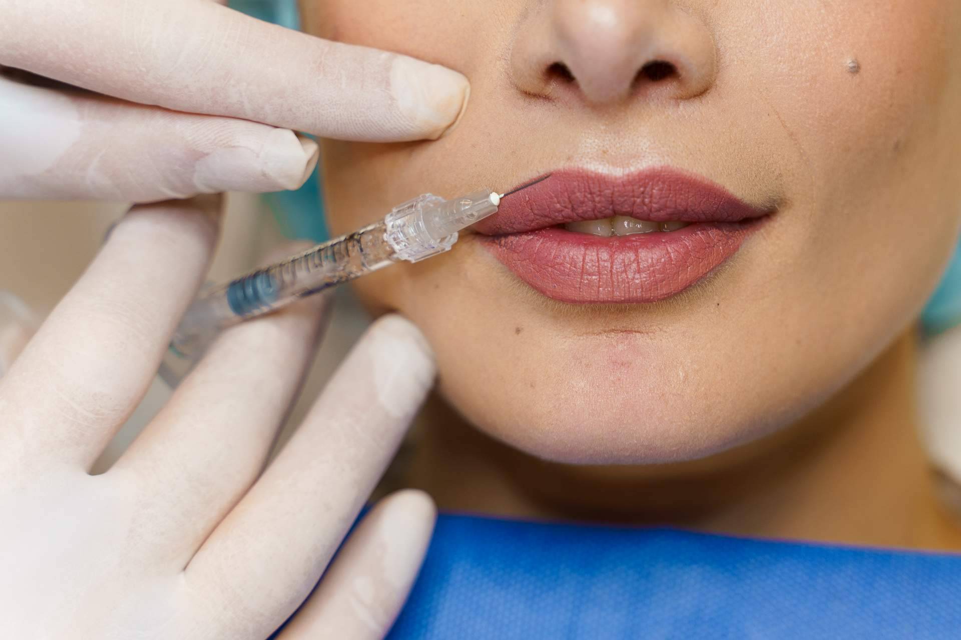 Clínicas Be presenta en qué consiste el aumento de labios realizado en sus centros