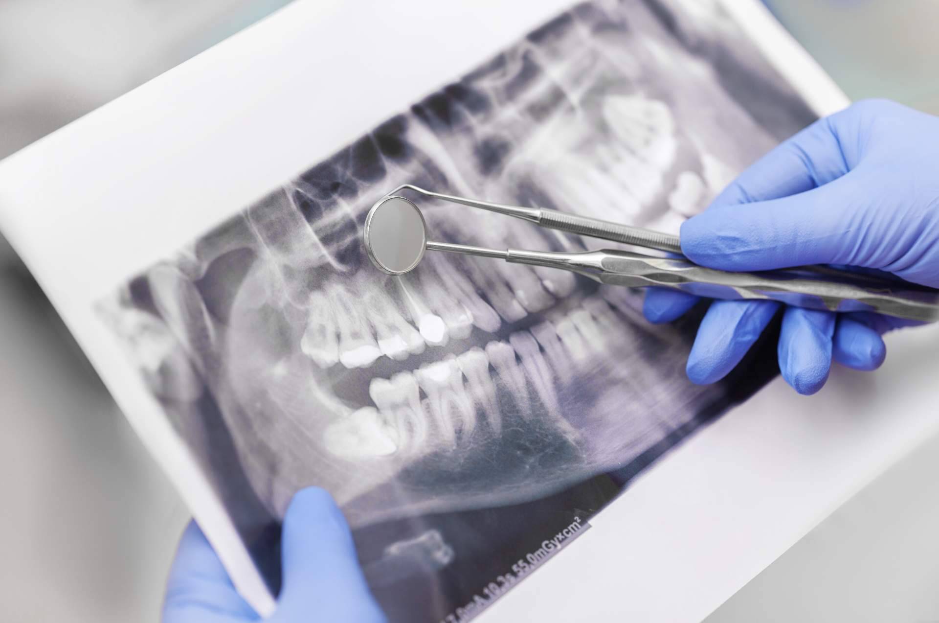 Las claves de un servicio técnico dental, de la mano de Star Dent