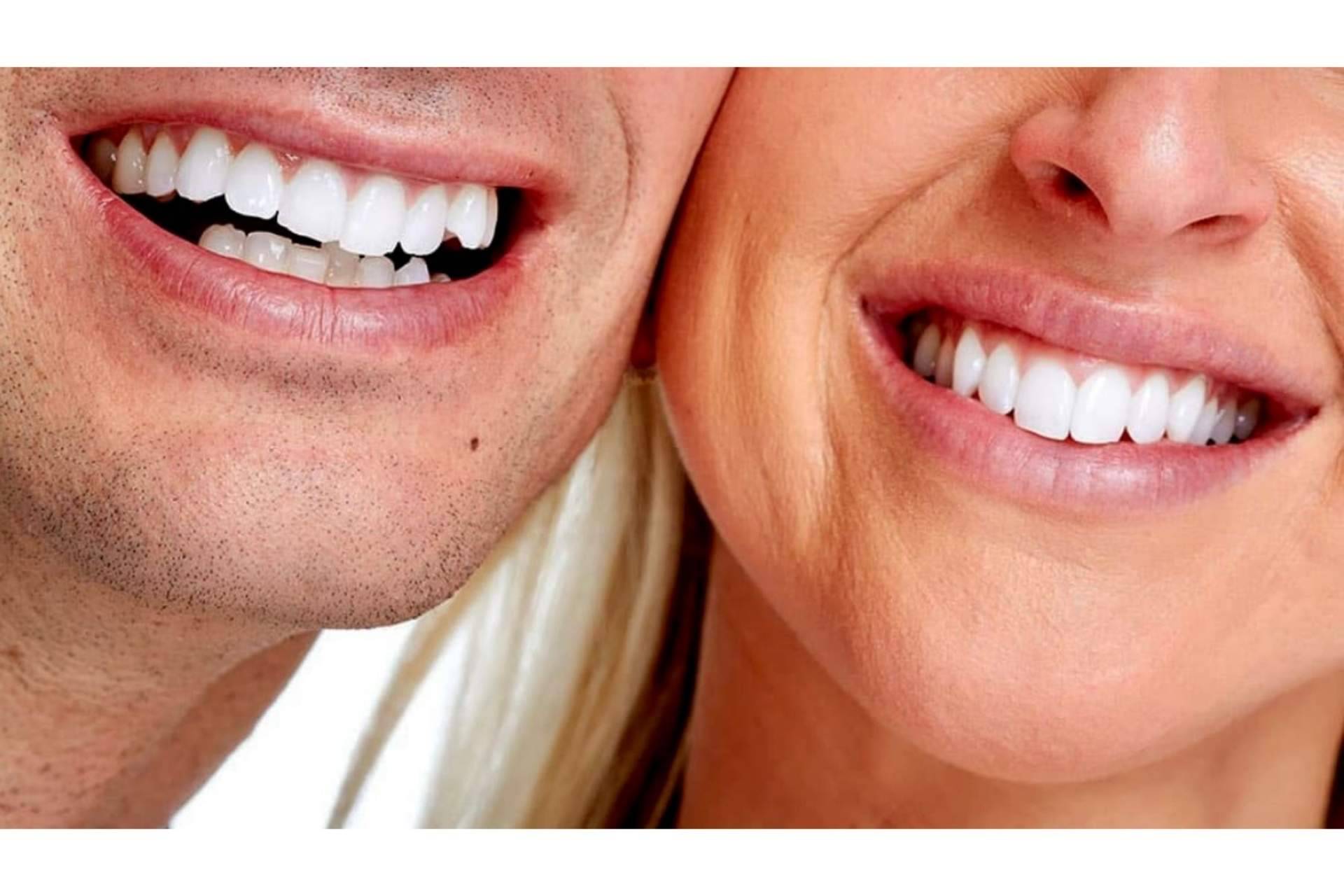 El servicio de DeltaDent para lucir una sonrisa bonita con la ayuda de la clínica dental de Madrid