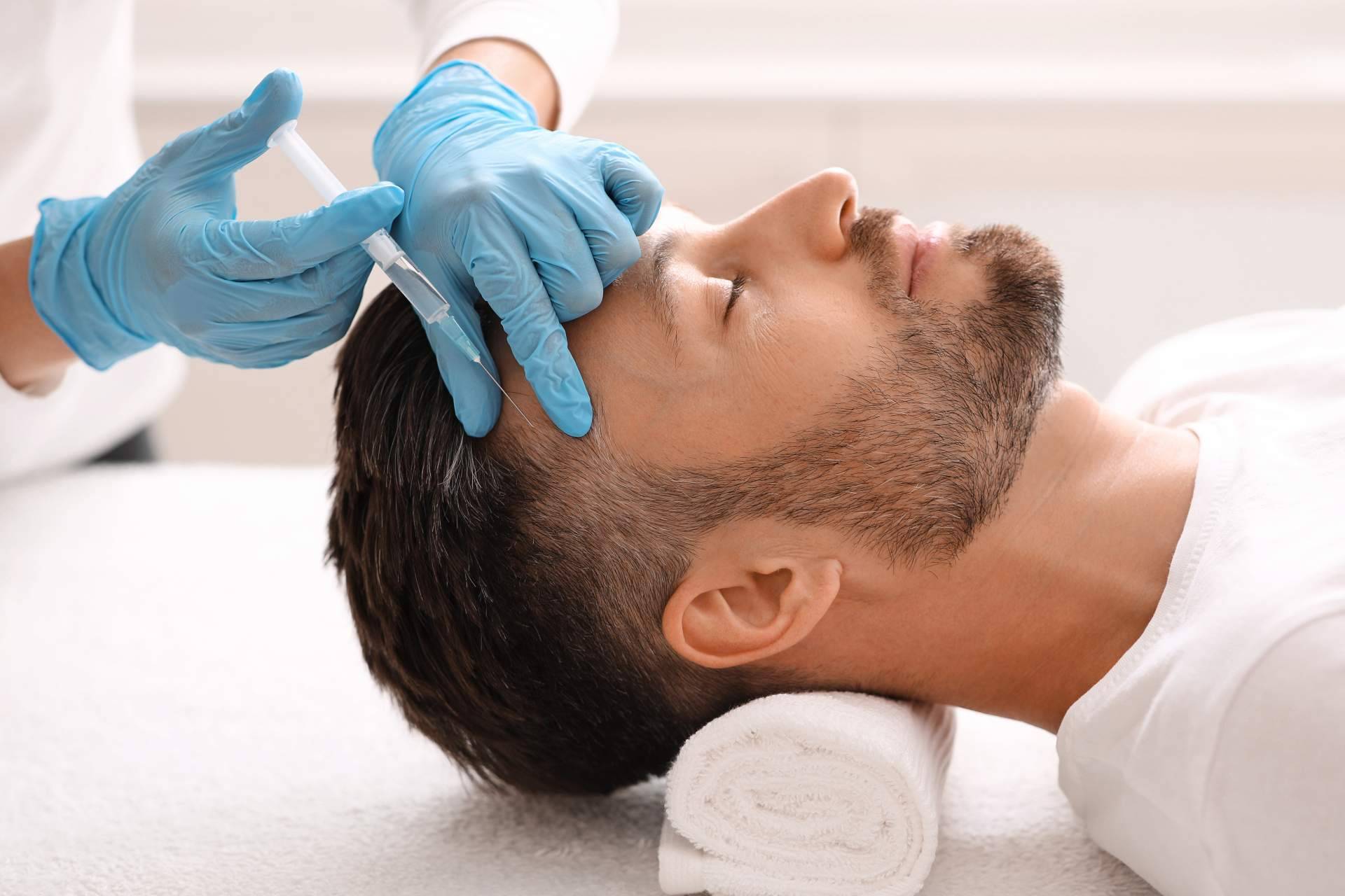 Los beneficios de la mesoterapia capilar Madrid de la mano de los profesionales de Crina Rus Beauty Center