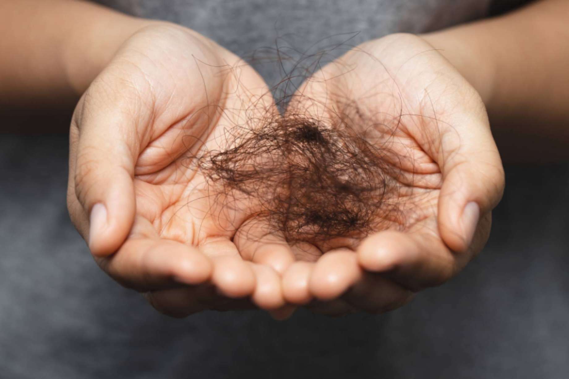 La alopecia femenina, ¿qué es y por qué se produce según Kmax?
