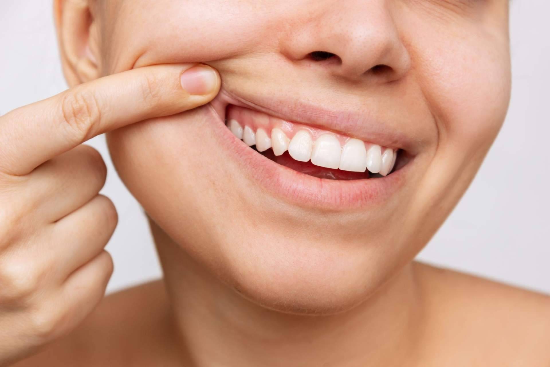 ¿Cuáles son las claves para tener salud bucodental? Farmasky