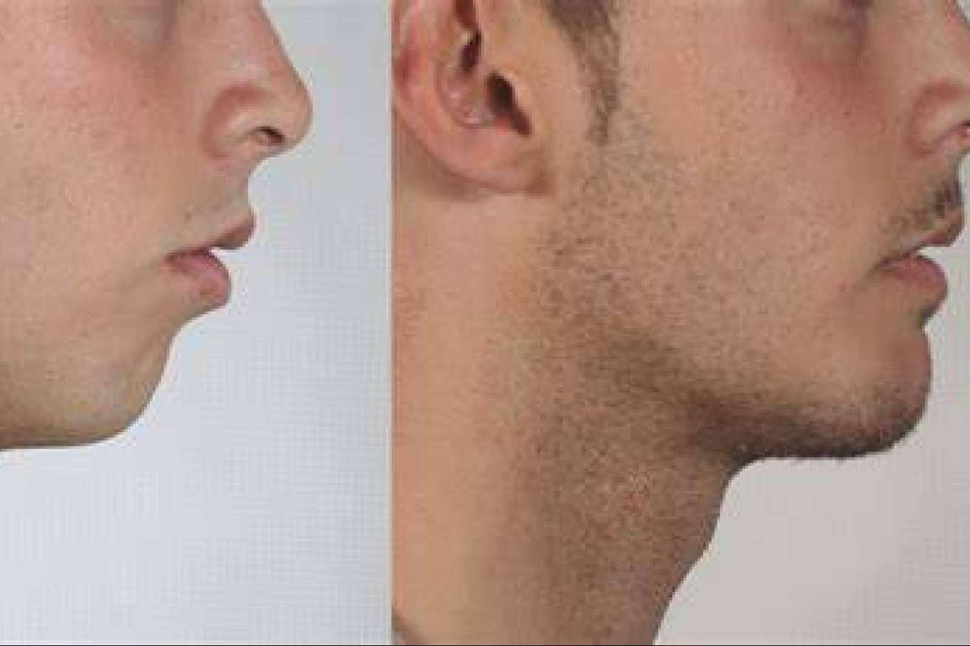 La Clínica Calvo de Mora es una clínica maxilofacial especializada en cirugías ortognáticas